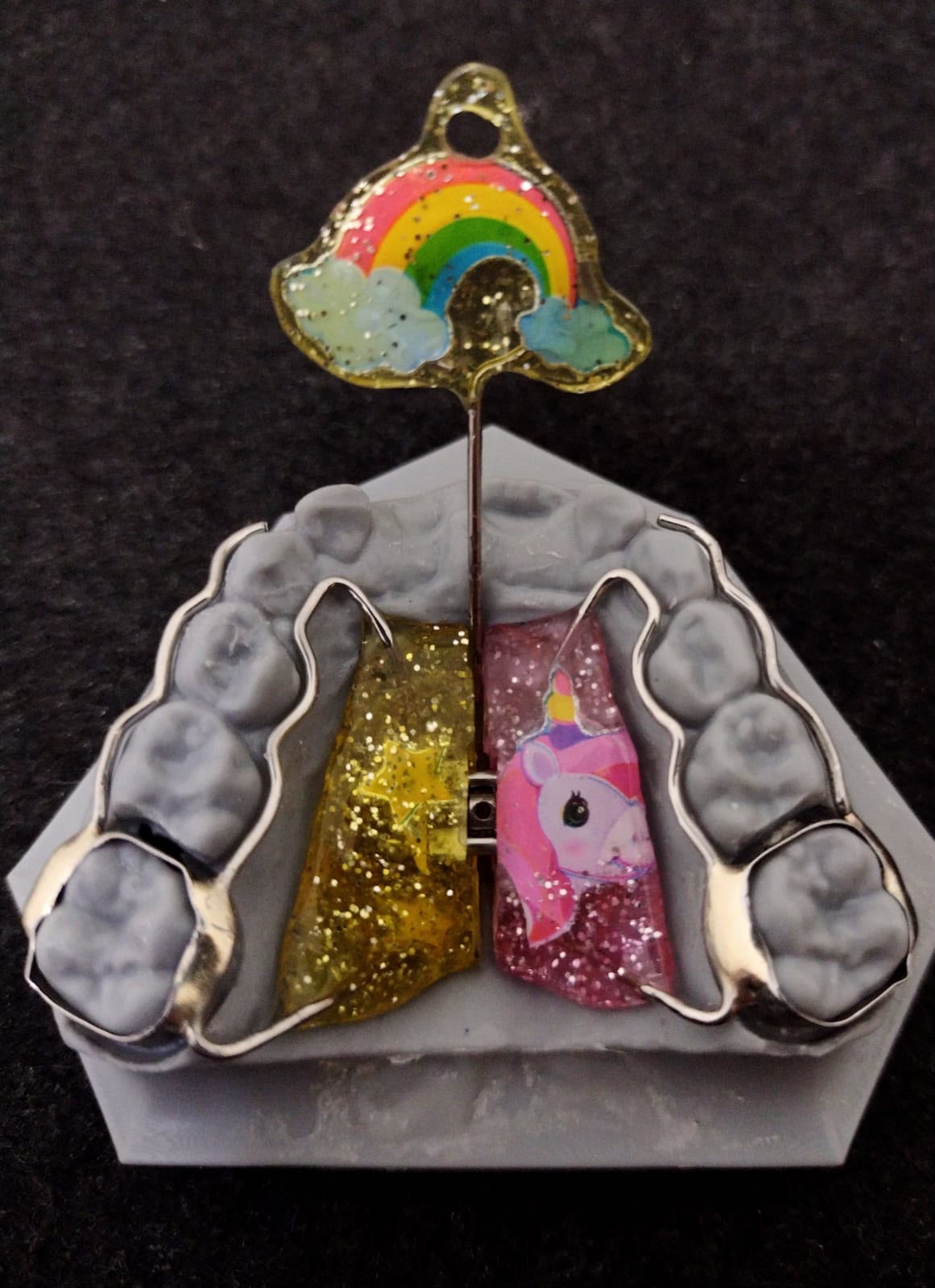 Aparelho ortodôntico infantil personalizado com glitter, unicórnio e arco-íris